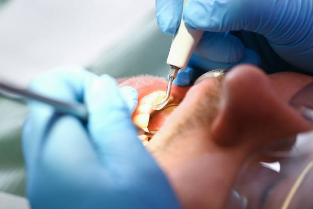 Best Weekend Emergency Dentist in Fenton, MO
